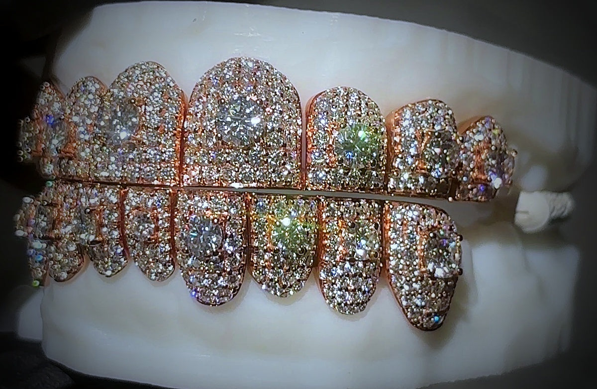 Mosaic setting iced out GRILLZ
